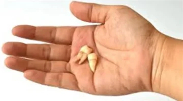 تفسير حلم سقوط الأسنان في اليد دون ألم يدل على مرور مرحلة انتقالية نفسية وتجديد داخلي